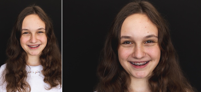 2 school photos of teen girl with braces | St. Louis School Photography